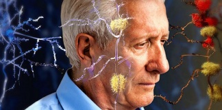 Descoperire importantă la Montreal privind boala Alzheimer