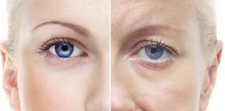 Fotoîmbătrânirea sau ravagiile expunerii la radiația ultravioletă