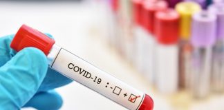 Este posibil să știm dacă o persoană a avut COVID-19 după ce s-a vindecat?