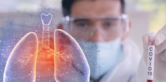 Cum atacă SARS-CoV-2 plămânii?
