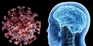 COVID-19 poate cauza unele complicaţii neurologice grave