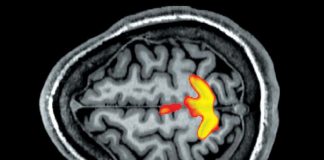 Bolile psihosomatice sau cum psihicul ne poate crea suferințe fizice