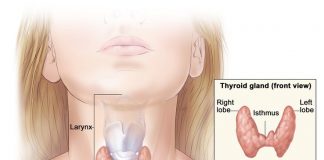 Hipotiroidia și plantele medicinale