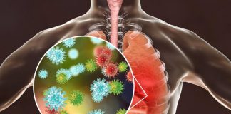 De ce sunt atât de multe infecții respiratorii virale în acest sezon?