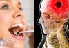 O sănătate orală precară ar putea duce la un risc crescut de accidente vasculare cerebrale