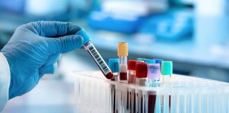 O nouă armă simplă și rapidă în lupta împotriva cancerului