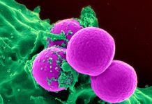 O nouă metodă pentru a bloca propagarea celulelor canceroase