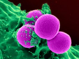 O nouă metodă pentru a bloca propagarea celulelor canceroase