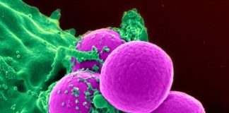 O nouă metodă pentru a bloca propagarea celulelor canceroase